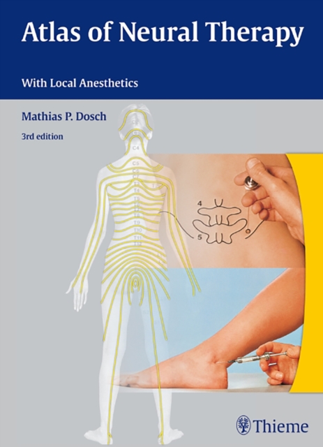 Atlas of Neural Therapy : With Local Anesthetics, Hardback Book