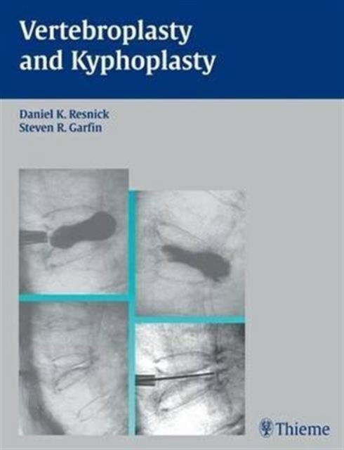 Vertebroplasty and Kyphoplasty, Hardback Book
