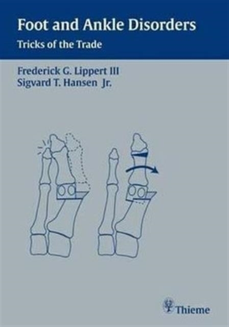 Foot and Ankle Disorders : Tricks of the Trade, Paperback Book