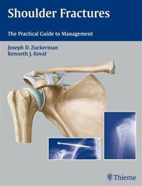 Shoulder Fractures : The Practical Guide to Management, Hardback Book