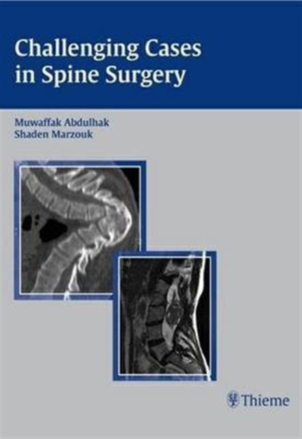 Challenging Cases in Spine Surgery, Hardback Book