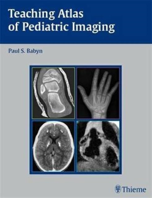 Teaching Atlas of Pediatric Imaging, Hardback Book