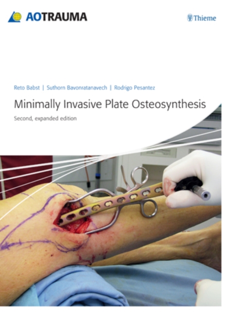 Minimally Invasive Plate Ostheosynthesis, Hardback Book