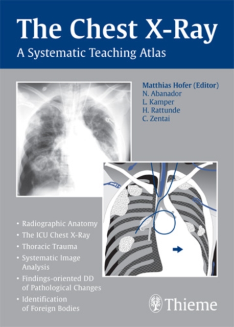 The Chest X-Ray : A Systematic Teaching Atlas, Paperback / softback Book