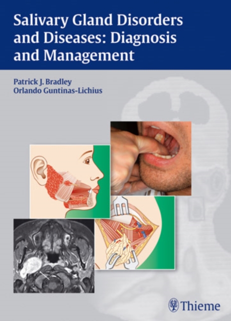 Salivary Gland Disorders and Diseases: : Diagnosis and Management, Hardback Book