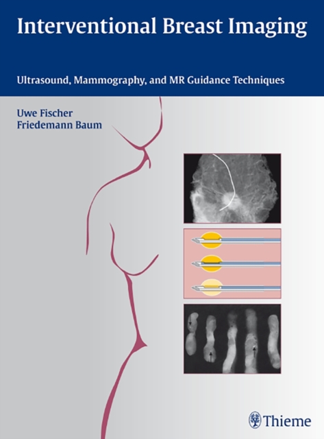 Interventional Breast Imaging : Ultrasound, Mammography, and MR Guidance Techniques, Hardback Book