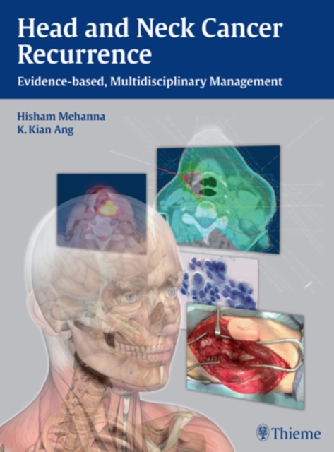Head and Neck Cancer Recurrence : Evidence-based, Multidisciplinary Management, Hardback Book