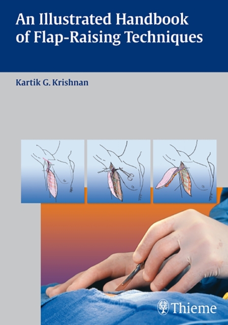 An Illustrated Handbook of Flap-Raising Techniques, Hardback Book