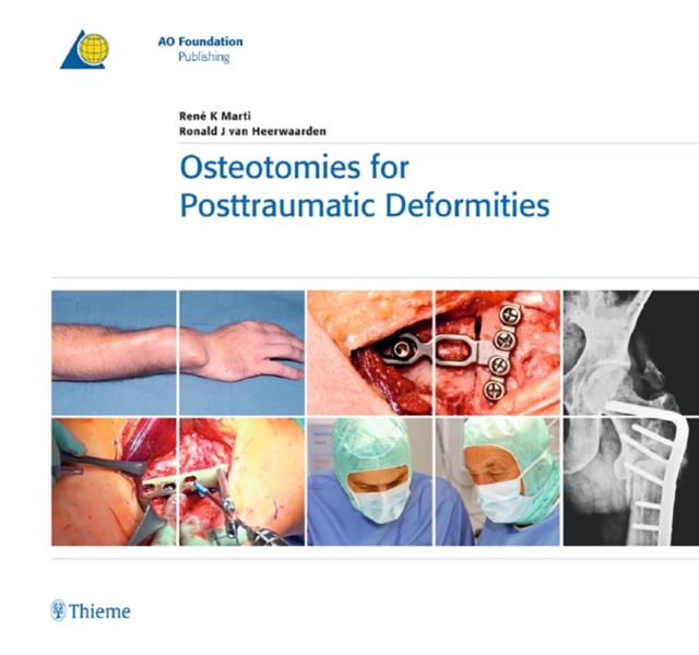 Osteotomies for Posttraumatic Deformities, Hardback Book