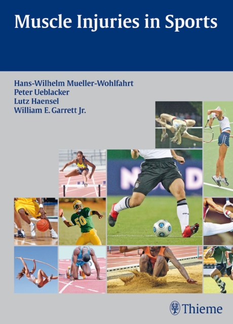 Muscle Injuries in Sports, Hardback Book