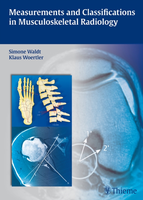 Measurements and Classifications in Musculoskeletal Radiology, Hardback Book