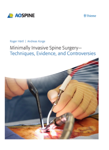 Minimally Invasive Spine Surgery - Techniques, Evidence, and Controversies, Hardback Book