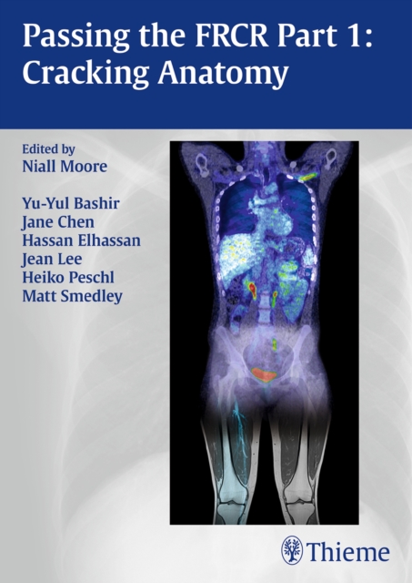 Passing the FRCR Part 1: Cracking Anatomy, Paperback / softback Book