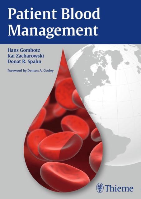 Patient Blood Management, Paperback / softback Book