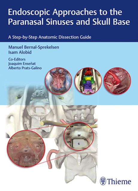 Endoscopic Approaches to the Paranasal Sinuses and Skull Base : A Step-by-Step Anatomic Dissection Guide, Hardback Book
