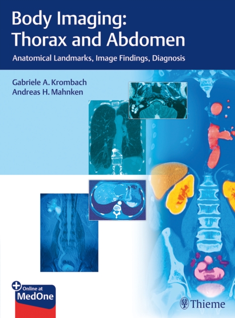 Body Imaging: Thorax and Abdomen : Anatomical Landmarks, Image Findings, Diagnosis, Mixed media product Book