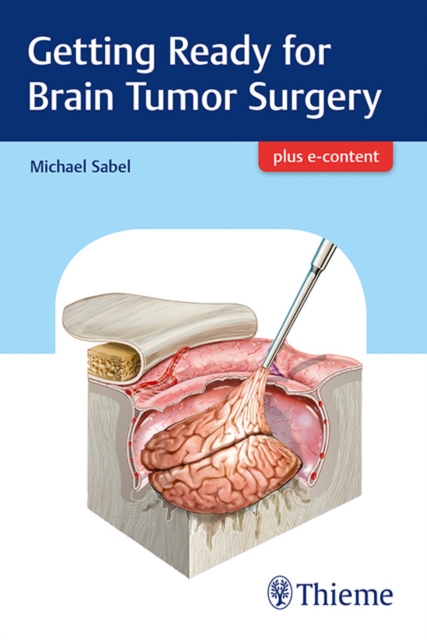 Getting Ready for Brain Tumor Surgery, Paperback / softback Book