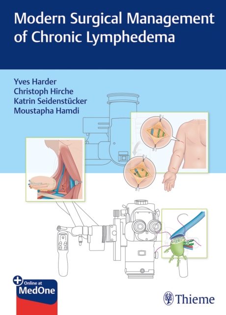 Modern Surgical Management of Chronic Lymphedema, Multiple-component retail product, part(s) enclose Book