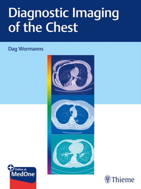 Diagnostic Imaging of the Chest, Mixed media product Book