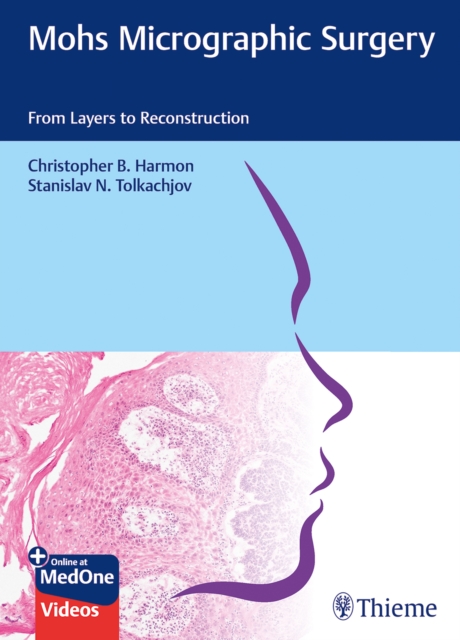 Mohs Micrographic Surgery: From Layers to Reconstruction, Multiple-component retail product, part(s) enclose Book