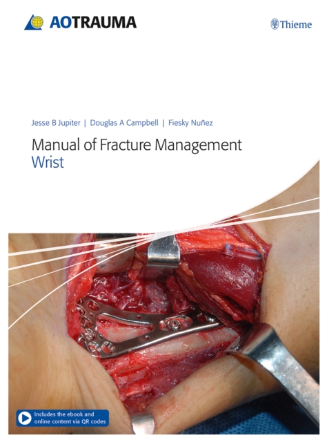 Manual of Fracture Management - Wrist, Multiple-component retail product, part(s) enclose Book