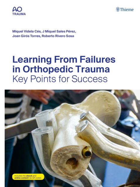 Learning From Failures in Orthopedic Trauma : Key Points for Success, Multiple-component retail product, part(s) enclose Book