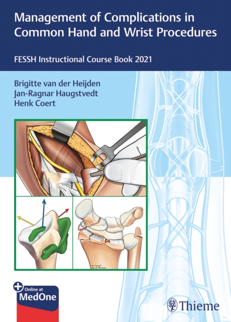 Management of Complications in Common Hand and Wrist Procedures : FESSH Instructional Course Book 2021, Mixed media product Book