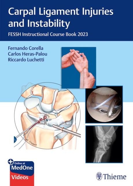 Carpal Ligament Injuries and Instability : FESSH Instructional Course Book 2023, Multiple-component retail product, part(s) enclose Book