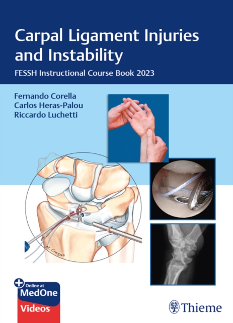 Carpal Ligament Injuries and Instability : FESSH Instructional Course Book 2023, EPUB eBook