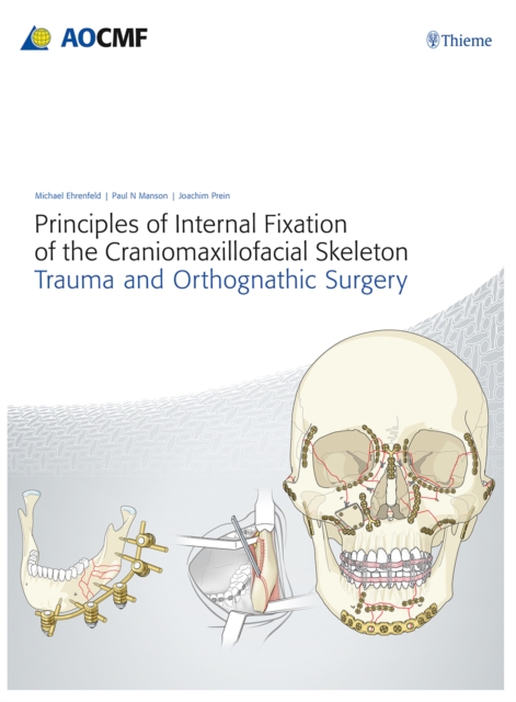 Principles of Internal Fixation of the Craniomaxillofacial Skeleton : Trauma and Orthognathic Surgery, Multiple-component retail product, part(s) enclose Book