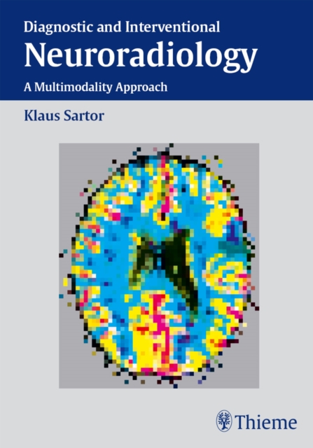 Diagnostic and Interventional Neuroradiology : A Multimodality Approach, EPUB eBook