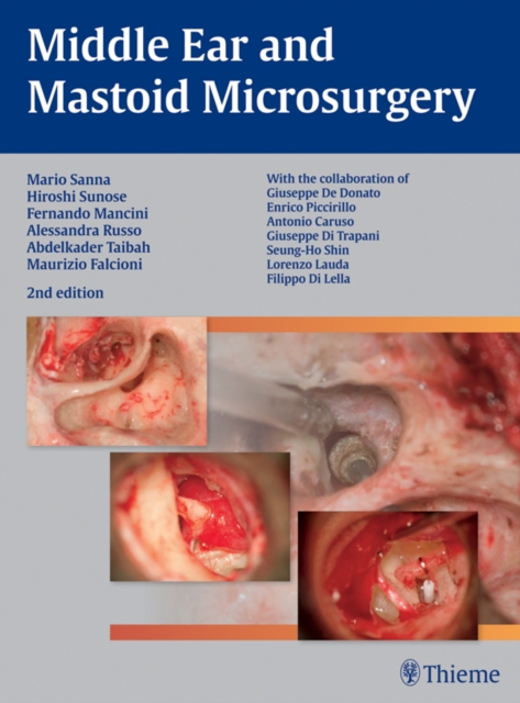 Middle Ear and Mastoid Microsurgery, EPUB eBook