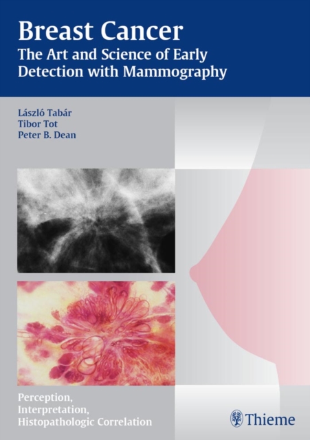 Breast Cancer - The Art and Science of Early Detection with Mammography : Perception, Interpretation, Histopathologic Correlation, EPUB eBook