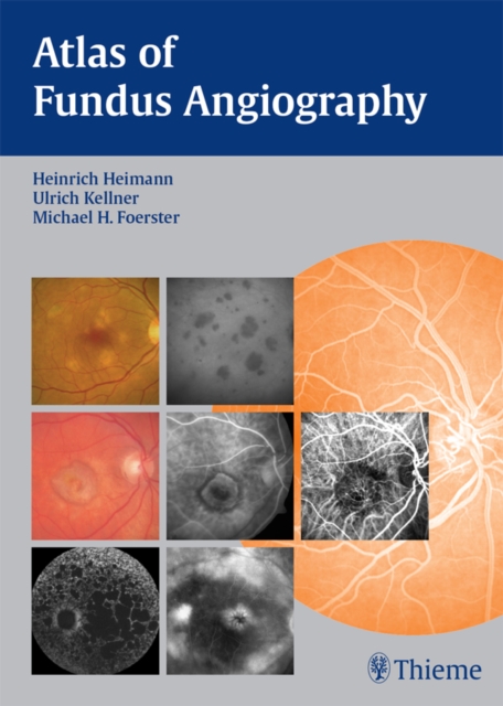 Atlas of Fundus Angiography, EPUB eBook