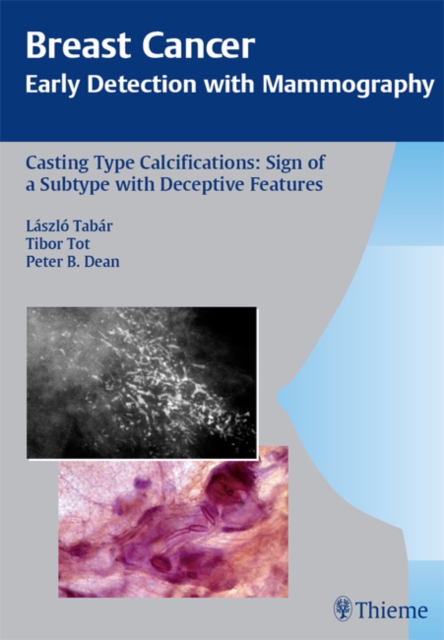 Breast Cancer: Early Detection with Mammography : Casting-Type Calcifications: Sign of a Subtype with Deceptive Features, EPUB eBook