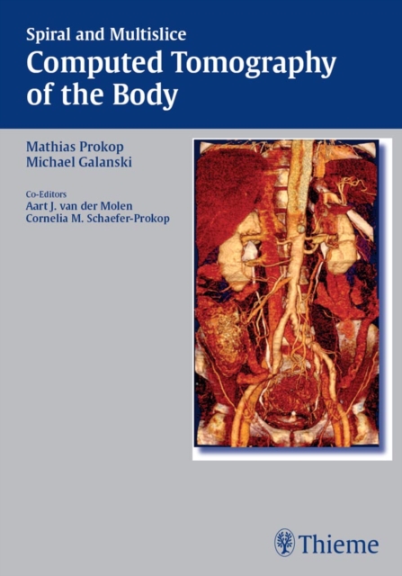 Spiral and Multislice Computed Tomography of the Body, EPUB eBook