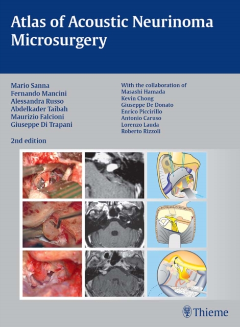 Atlas of Acoustic Neurinoma Microsurgery, EPUB eBook