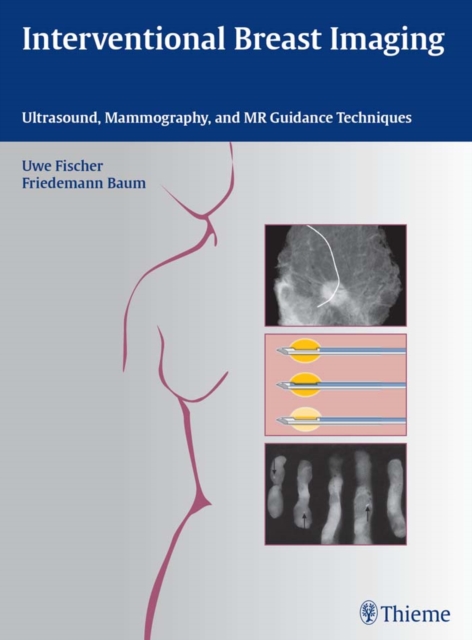 Interventional Breast Imaging : Ultrasound, Mammography, and MR Guidance Techniques, EPUB eBook