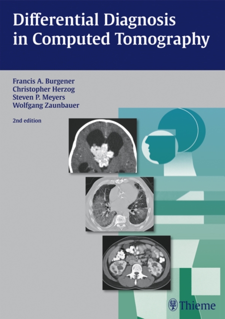 Differential Diagnosis in Computed Tomography, EPUB eBook
