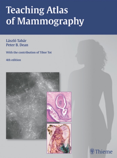 Teaching Atlas of Mammography, EPUB eBook