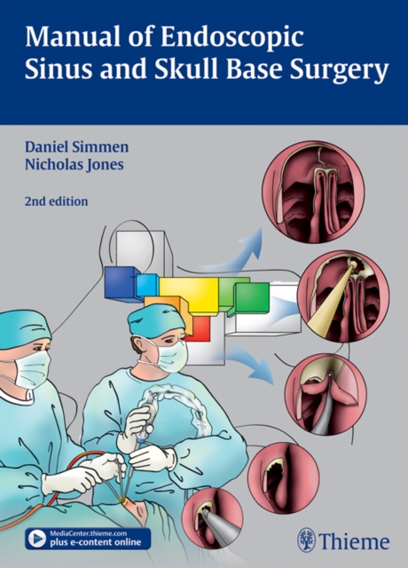 Manual of Endoscopic Sinus and Skull Base Surgery, EPUB eBook