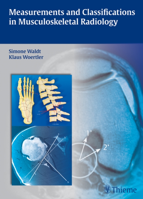 Measurements and Classifications in Musculoskeletal Radiology, EPUB eBook