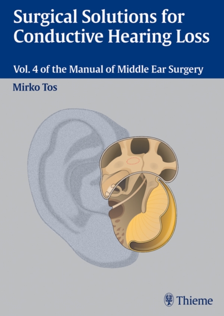 Surgical Solutions for Conductive Hearing Loss : Vol. 4 of the Manual of Middle Ear Surgery, EPUB eBook