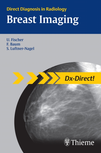 Breast Imaging : Direct Diagnosis in Radiology, EPUB eBook