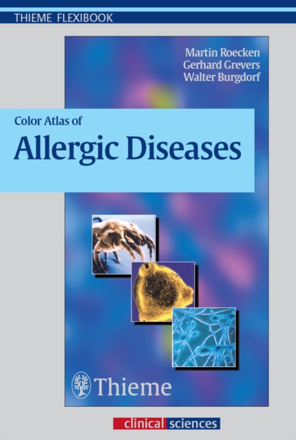 Color Atlas of Allergic Diseases, EPUB eBook