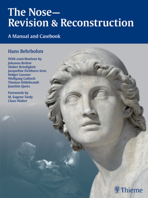 The Nose - Revision and Reconstruction : A Manual and Casebook, EPUB eBook