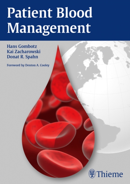 Patient Blood Management, EPUB eBook