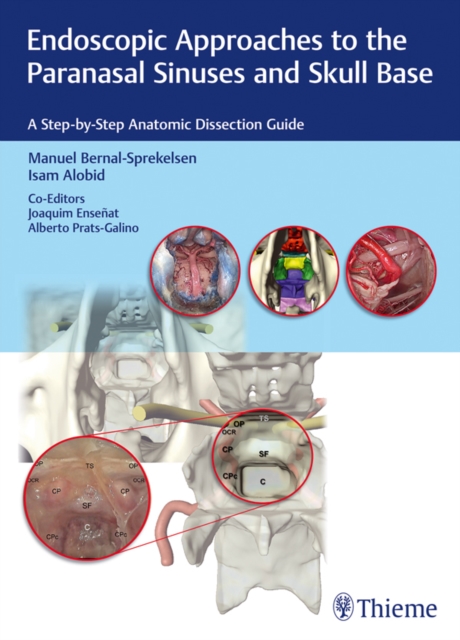 Endoscopic Approaches to the Paranasal Sinuses and Skull Base : A Step-by-Step Anatomic Dissection Guide, EPUB eBook