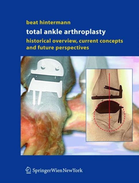 Total Ankle Arthroplasty : Historical Overview, Current Concepts and Future Perspectives, Hardback Book
