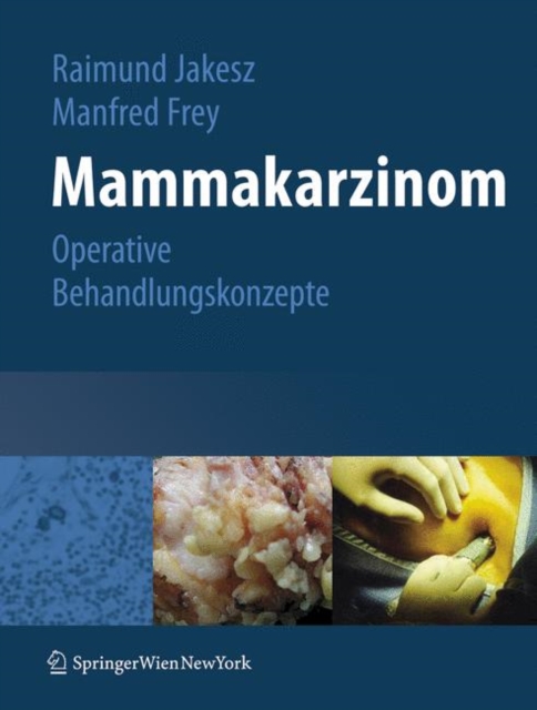 Mammakarzinom : Operative Behandlungskonzepte, Book Book